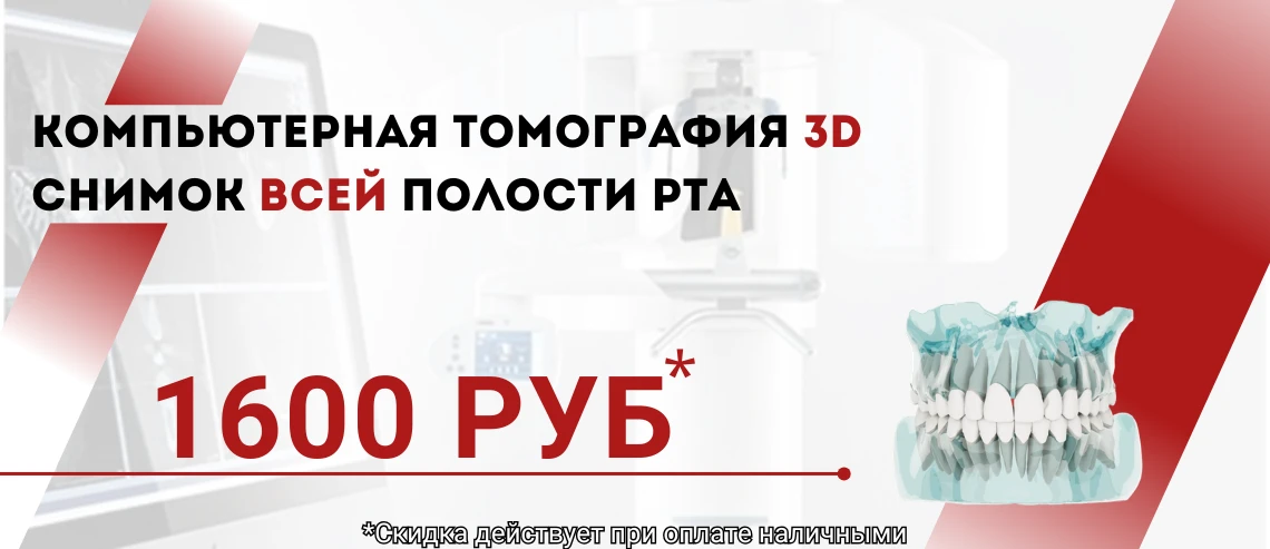 СКИДКА НАКОМПЬЮТЕРНУЮ ТОМОГРАФИЮ (КТ)