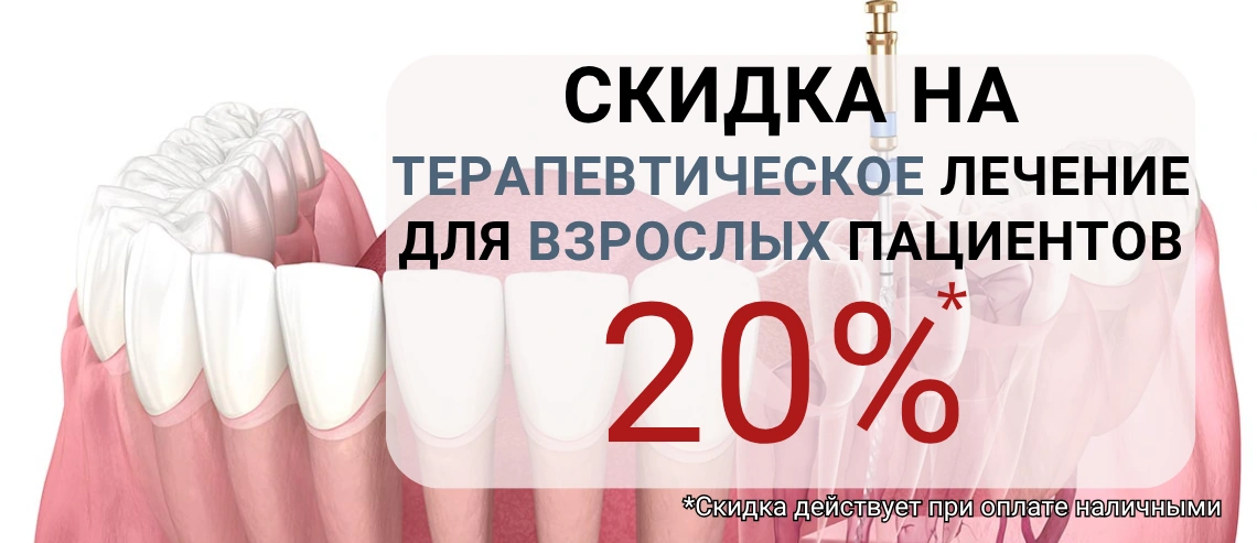 Терапевтическое лечение для взрослых — скидка 20%. Скидка действует при оплате наличными.